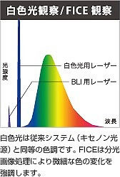 白色光観察/FICE観察