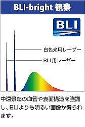 BLI_bright観察