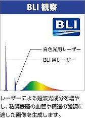 BLI観察