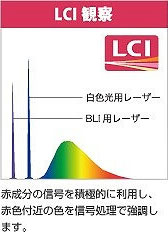 LCI観察