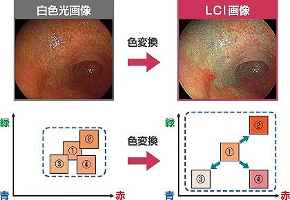 白色光画像→LCI画像